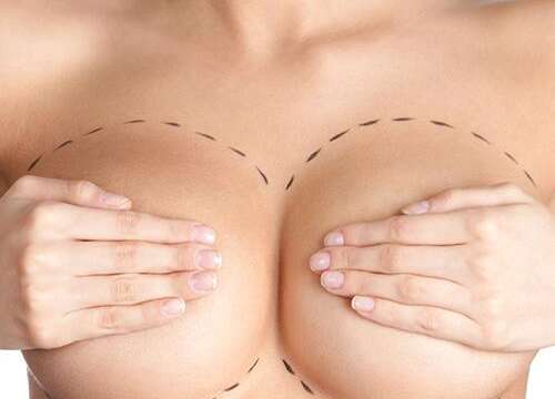 Breast Surgery | Dr. Imad Shehadi